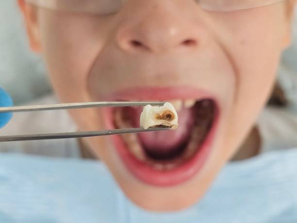 Best Emergency Care for Gum Disease in South Hutchinson, KS