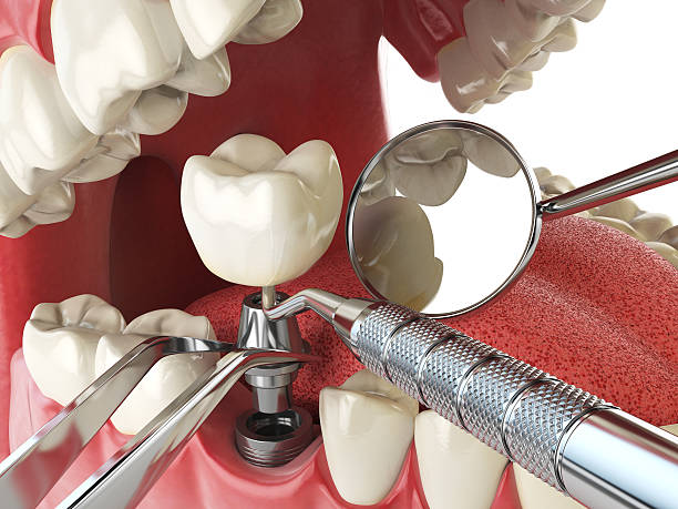 Best Emergency Orthodontic Repairs in South Hutchinson, KS